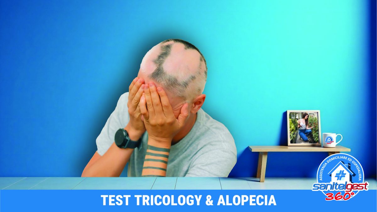 SCOPRI SE HAI UNA PREDISPOSIZIONE GENETICA ALL’ALOPECIA